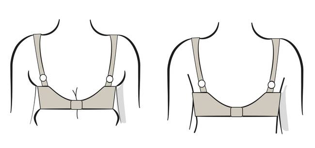 Measuring the breast base width while pinching the skin to simulate the